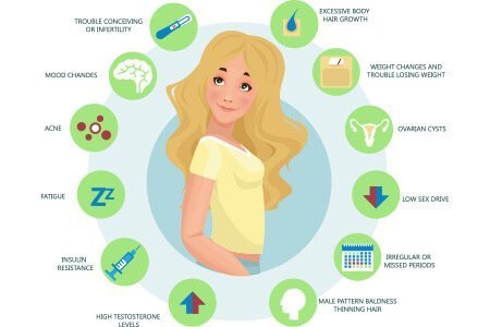 Living with PCOS: More Than Just a Hormonal Imbalance